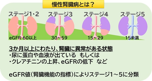 慢性腎臓病とは